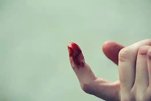 血,人,手指,手,手掌,伤口,受伤,出血,鲜明,红色,户外,模糊,散焦,绿色