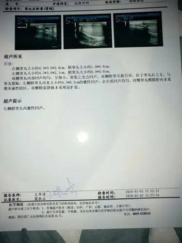 我的阴囊内有很多血管 一吸气左侧睾丸会翘起来 麻烦各位帮我看看有没