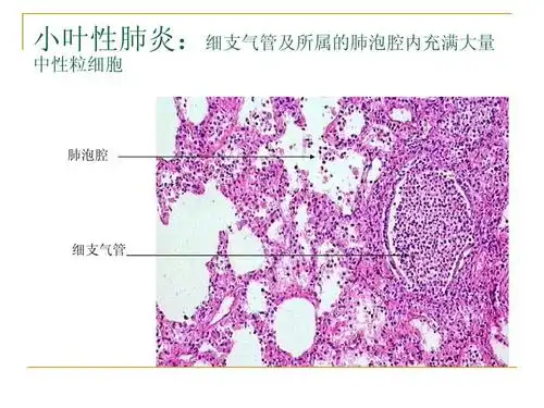 病理学实验切片考试题图集答案ppt