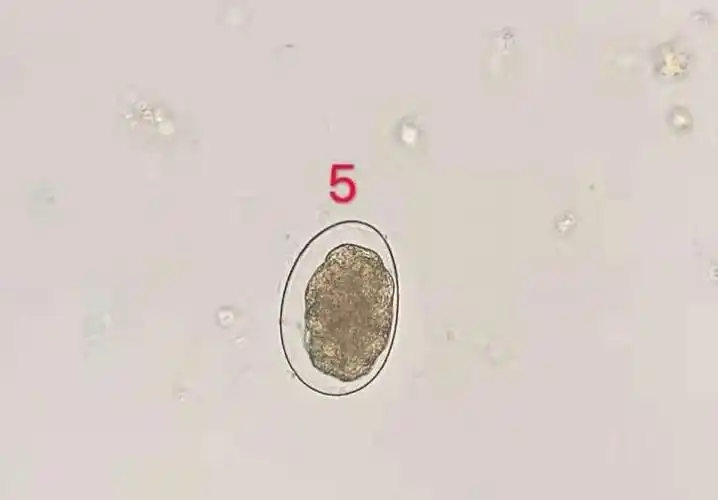 12.04寄生虫卵