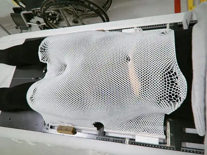 直肠癌术后放疗定位