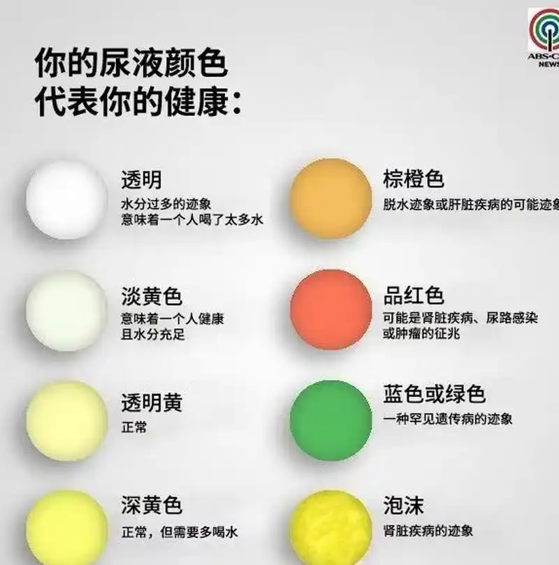 你的尿液颜色代表你的健康,对照自查一下