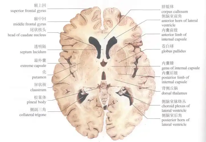 端脑的内部结构(横切面)