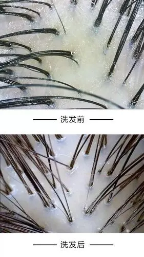 头皮健康测试,发用洗剂效果体验,灵豹药业"关爱国人头皮健康"公益活动