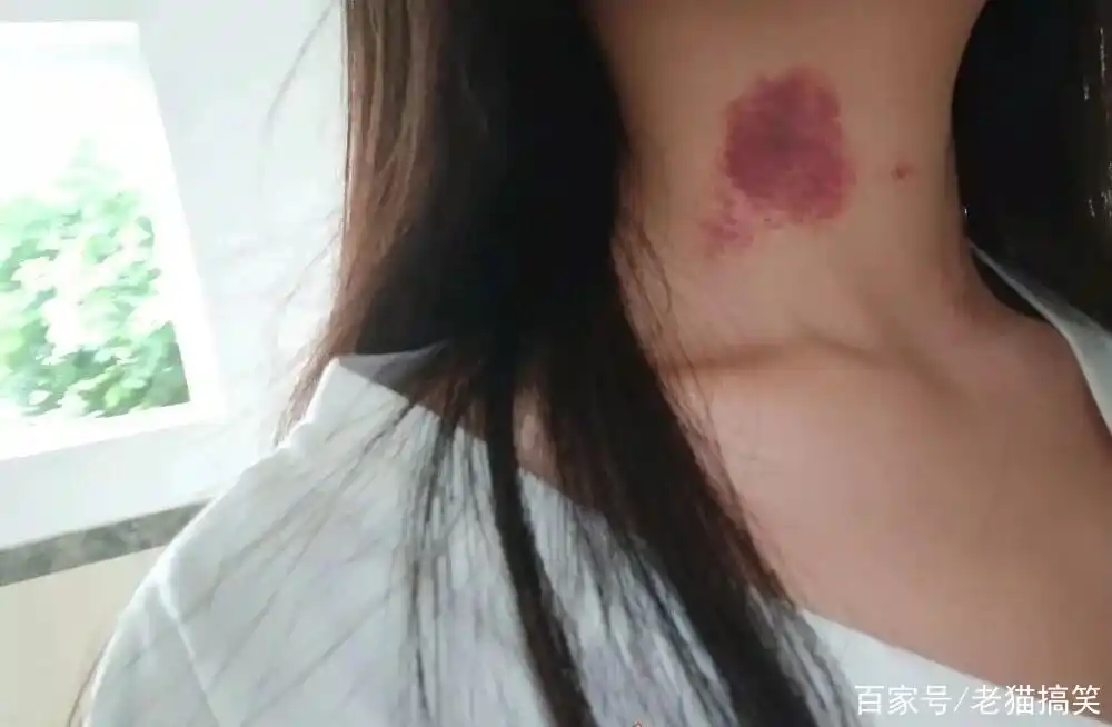 被种草莓真的会死掉吗,请告诉我