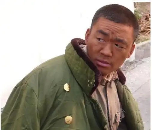 中国十大最丑的明星第一是当之无愧陈凯师只排第7位