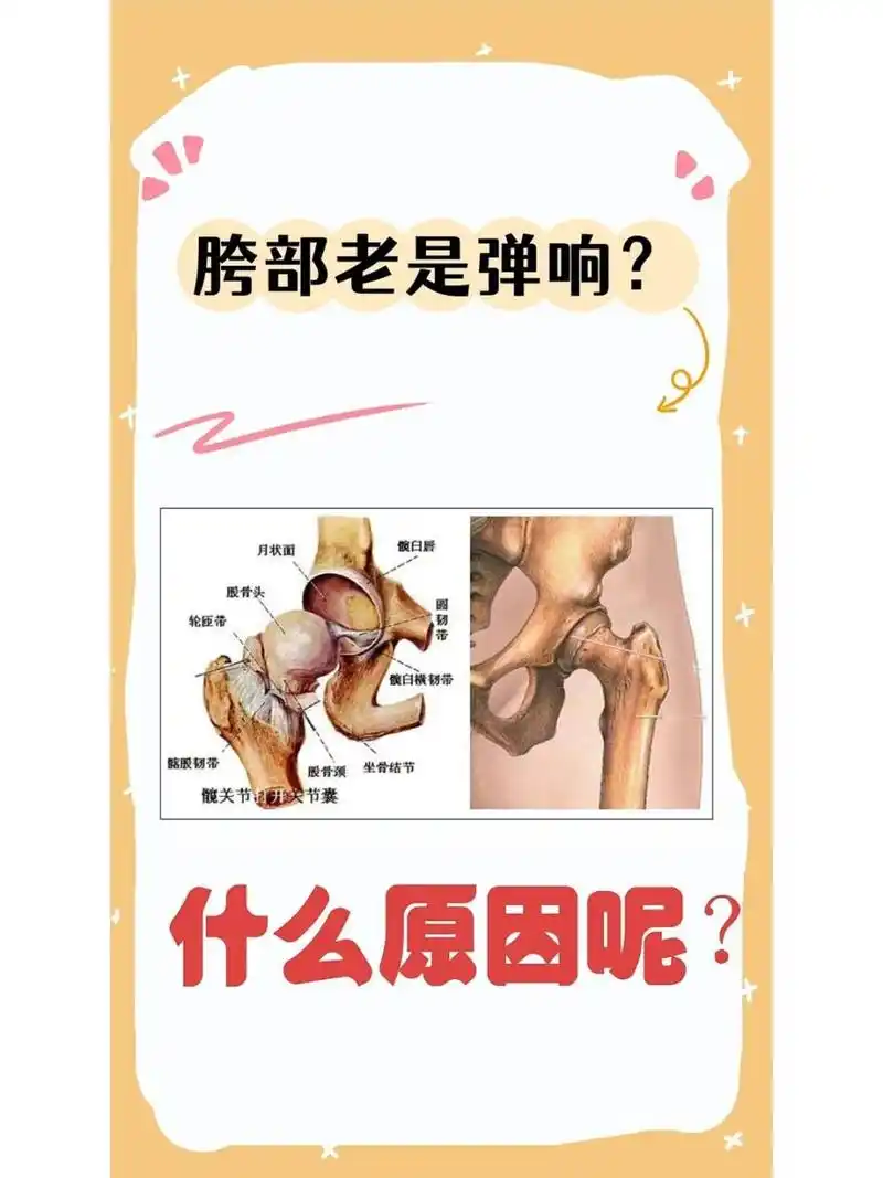 髋部经常弹响,原因究竟是?