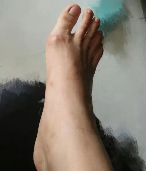 我是女生,脚又丑又大,好自卑.