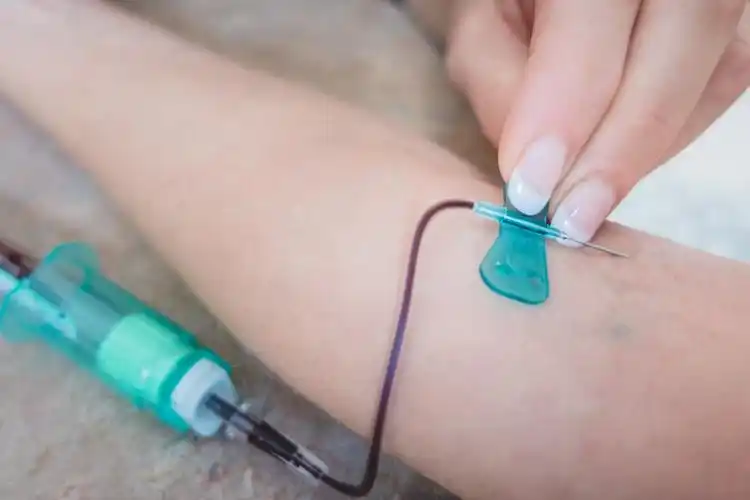 为什么抽完血后胳膊会出现淤青看完涨知识了