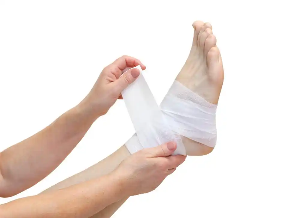 踝关节骨折,护士包扎孤立的脚踝