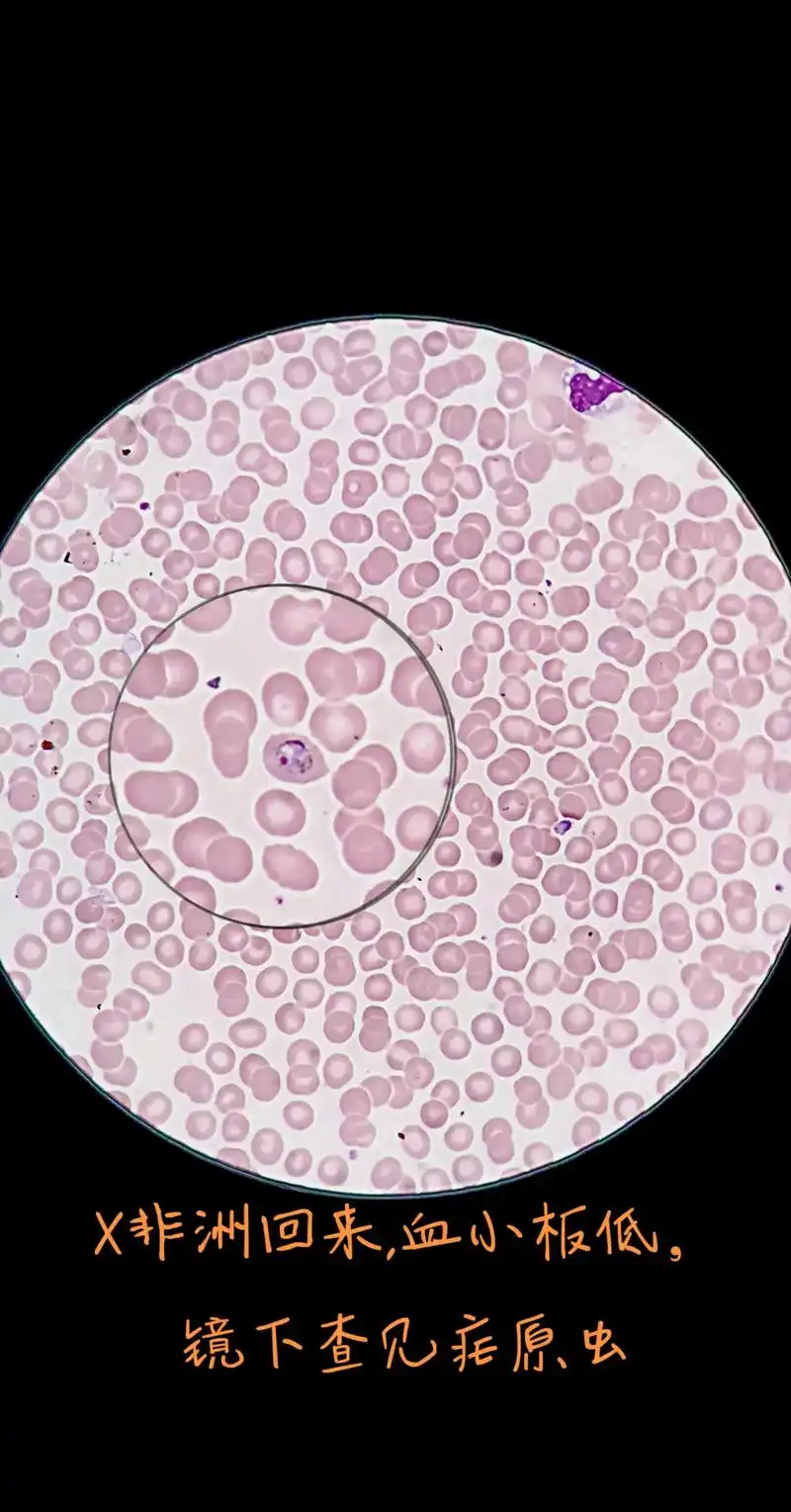 生物实验室 #免疫细胞 #细菌感染 #微观世界 #微生物 - 抖音