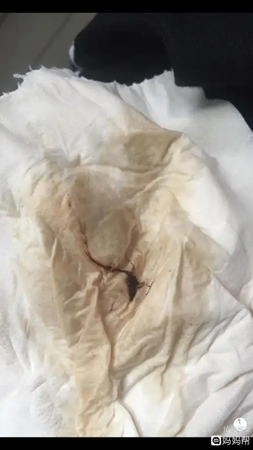 沉着!怀孕初期少量出血"只为圆梦"-第2张图片-追风博客