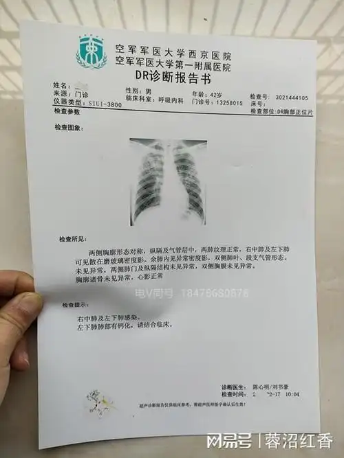 怎样减少急性阑尾炎的病假病历发生?