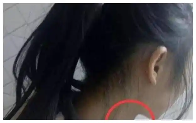 12岁女孩长胡子,有喉结,只因常吃3种食物,家长别不当回事儿