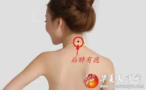 "背有痣,穷一生"说法准吗?