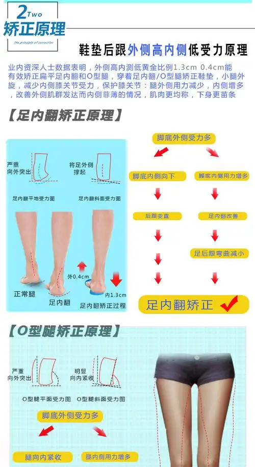 o型腿矫正鞋垫男女o型腿矫正带足内翻外八字外侧磨损腿型矫正垫墨斗潮