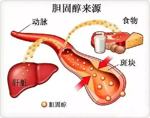 2,什么是高血脂?