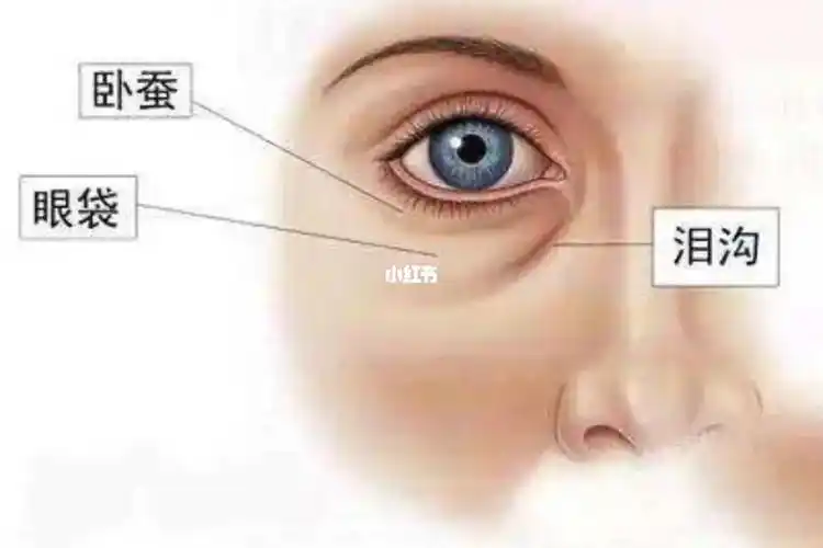 有很多人分不清眼袋泪沟黑眼圈卧蚕02