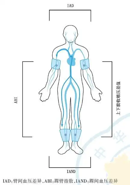 哪些人需要测量四肢血压