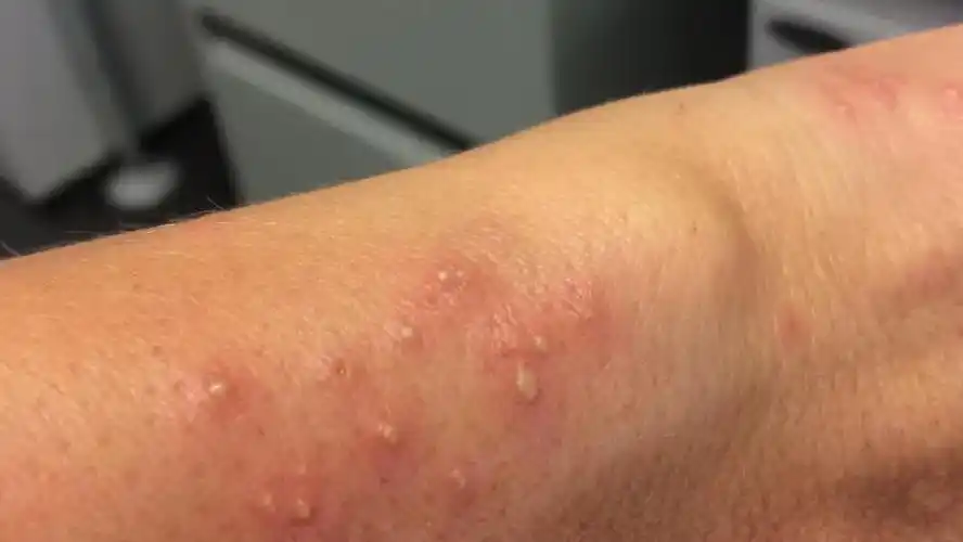 当我们讨论红火蚁的毒性时它们已经在解决种群内卷的问题了