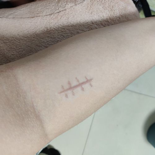 假伤口贴仿真疤痕万圣节cos化妆手术缝针拆线后假疤剧组 三厘米拆线