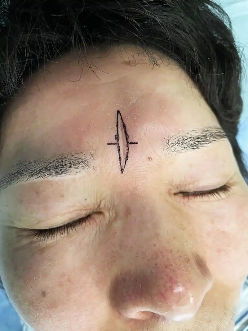 人到中年,印堂现川字纹,苦大仇深让人不敢靠近,好痛苦啊