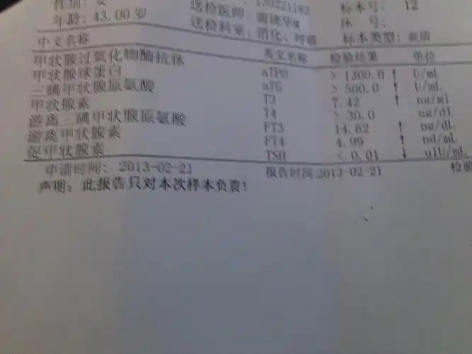 chanmian7m | 发布于2013-03-15 19:27  评论 抗tg抗体  甲状腺