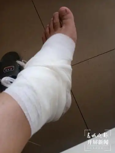 地震现场大理一名辅警被落石砸伤脚踝他咬牙坚守在保通一线