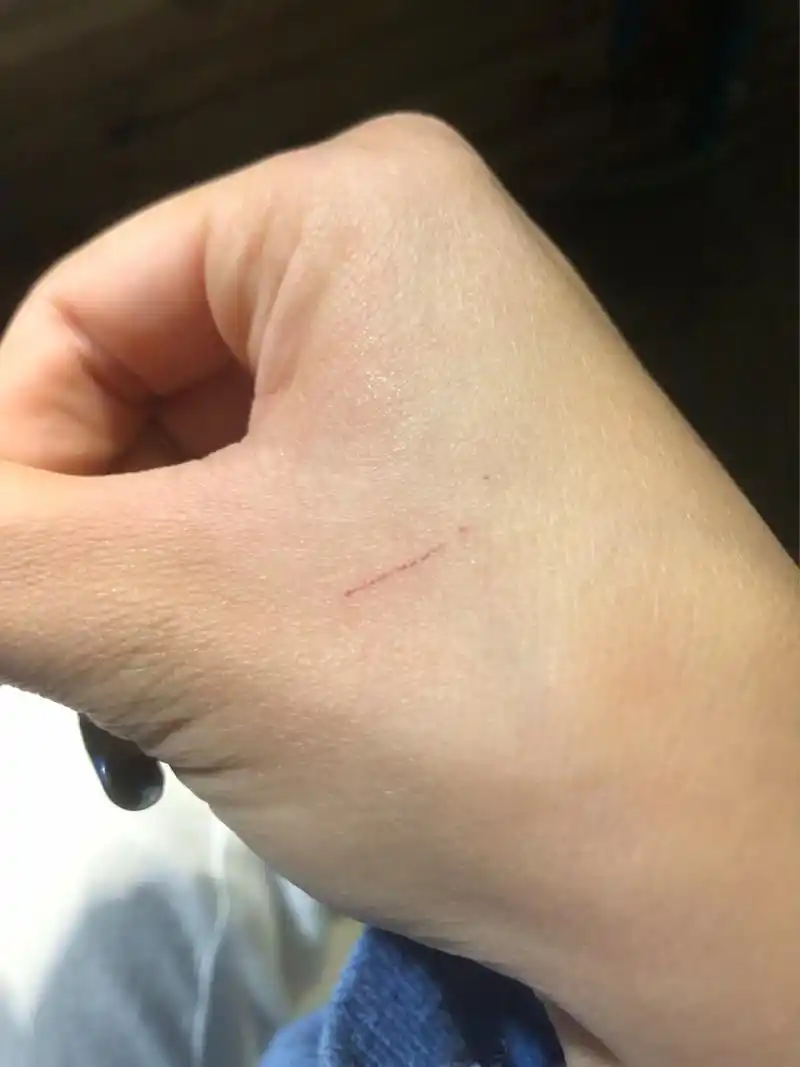 刚收养了两周的流浪猫,打了驱虫,去医院查了抗体很强,不需要打疫苗的