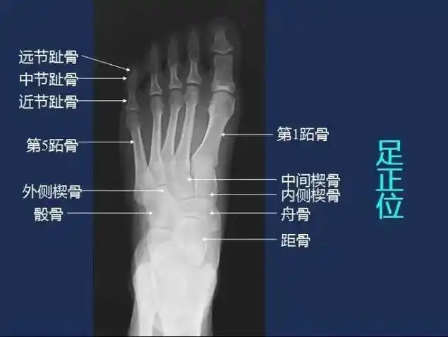 足部解剖需要保存 - 抖音