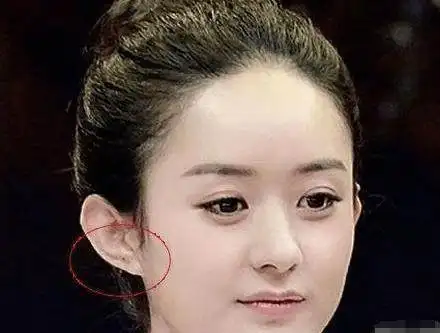 2,右耳有痣:帮夫运,耳朵上的痣大多都是好痣,耳垂有痣的人聪明,孝敬