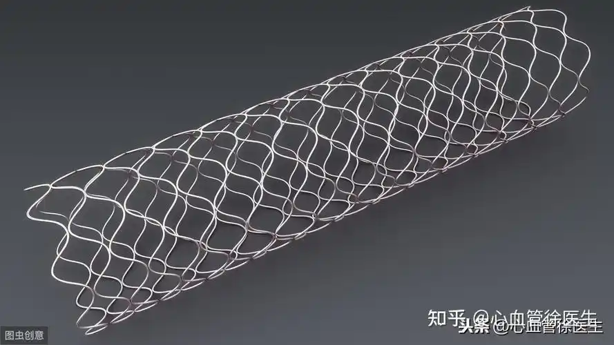 心脏支架是什么?有哪些类型?国产的好还是进口的好?