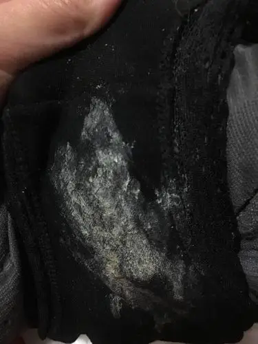 我有妇科炎症,最近白带又不正常了!黄色结痂状,异味重.