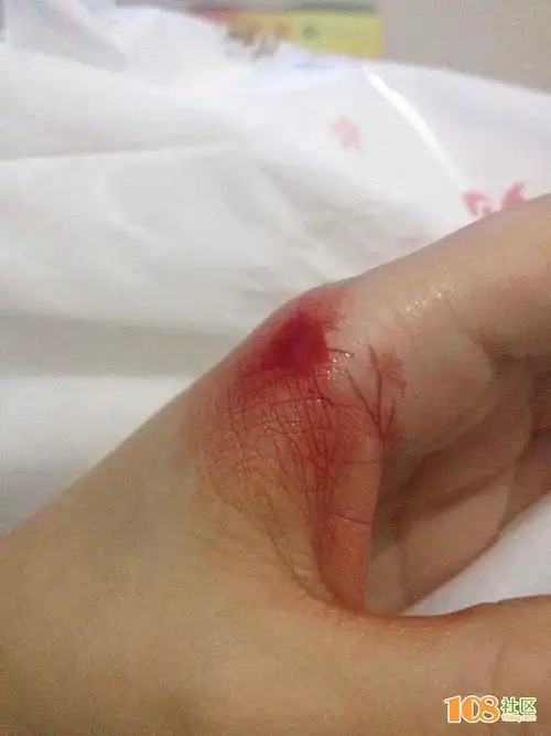 洗完割到手了,超级痛