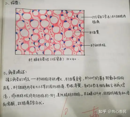 肝脂肪变性8915肉芽组织8915慢性肺淤血8915炎细胞89