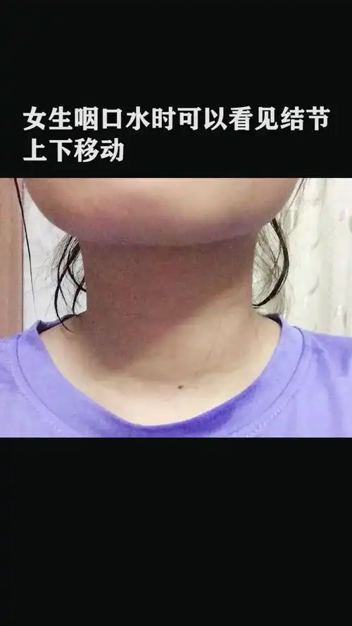 通过咽口水可以初步判断甲状腺结节的情况