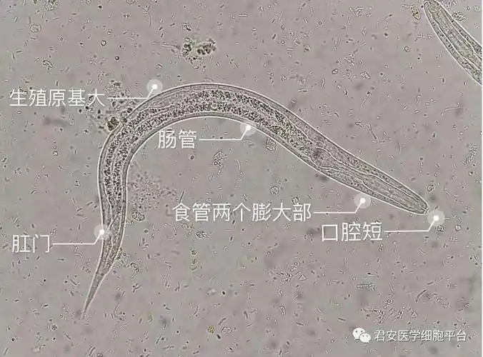 绝版推送震撼来袭一文看尽粪类圆线虫前世今生