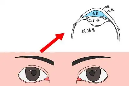 什么叫眼睛前房图片