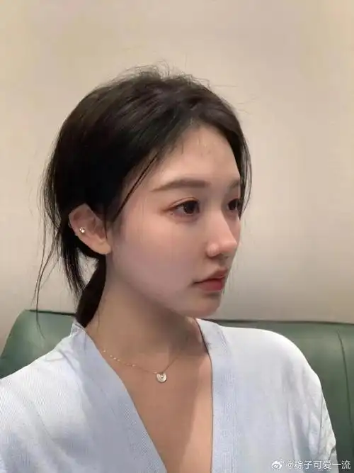 上海隆鼻投稿:鼻子侧面非常好看,而且弧度什么的都很自然,颜值提升了