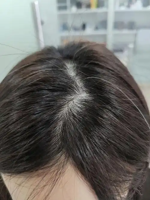 好想听听对30女生长白头发有什么建议