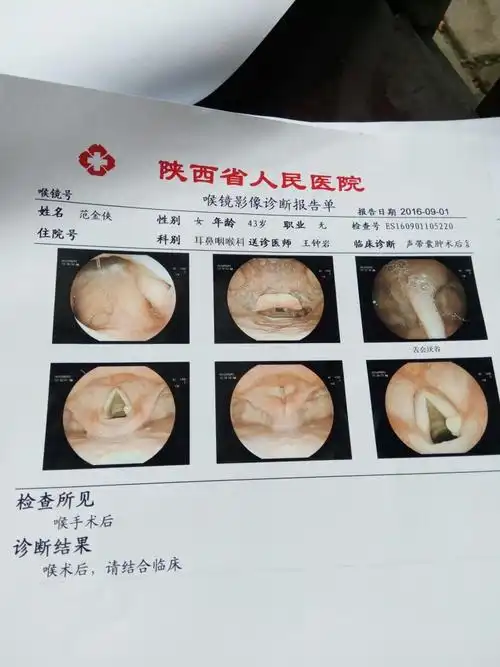 你好～一个月前做声带囊肿手术～一个月后复查发现在原地几乎和术前一