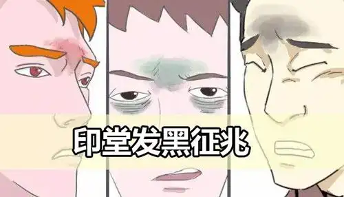 印堂发黑是什么不详的征兆吗