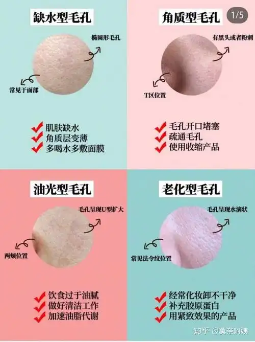 毛孔现象:黑色或米白色的圆形孔状粉刺,有时会有粉刺突出物. 恭喜你!