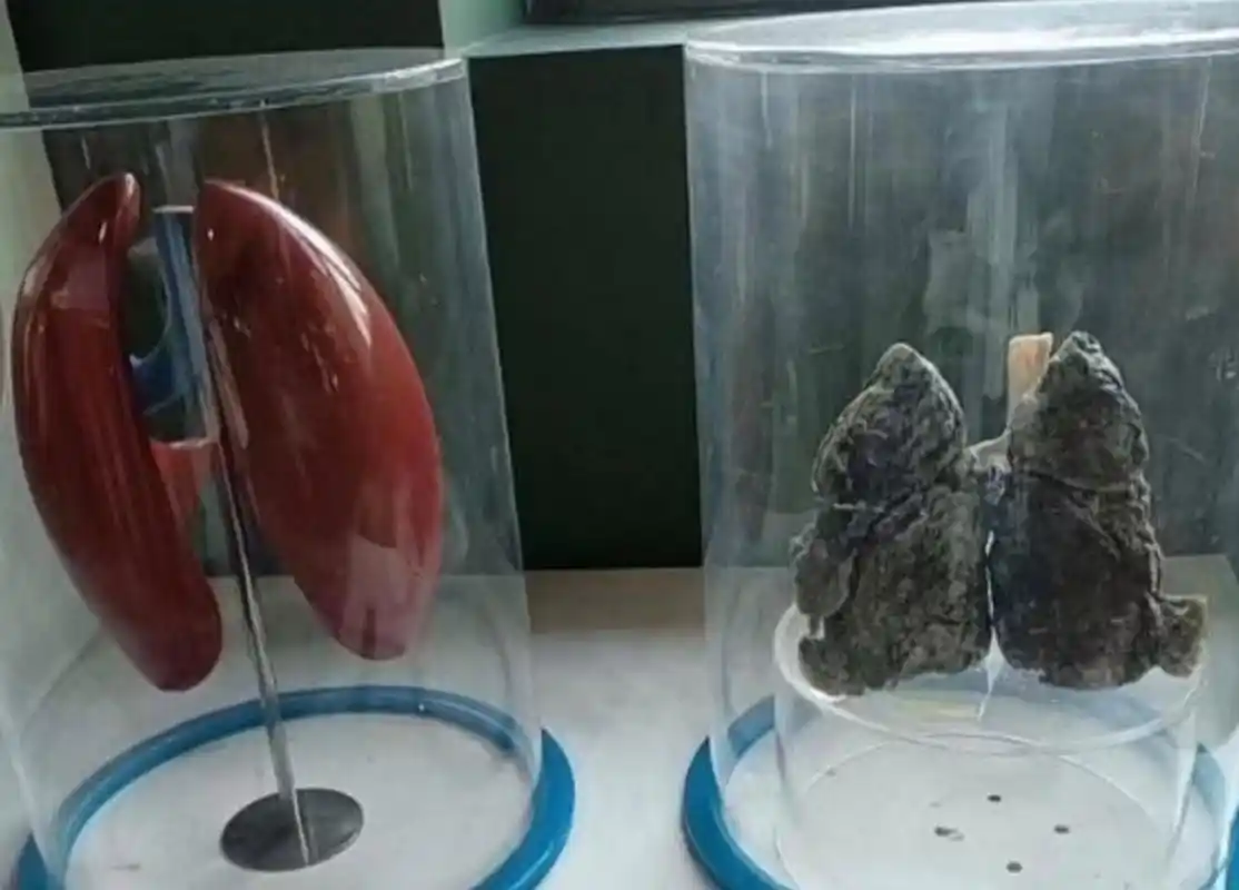 吸烟者的肺,看到这还不戒烟吗?