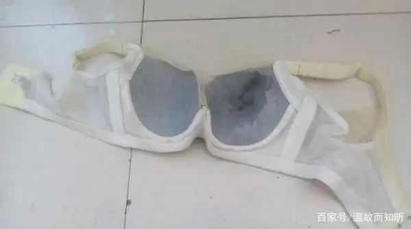 乳头溢液可表现为内衣容易变脏变湿