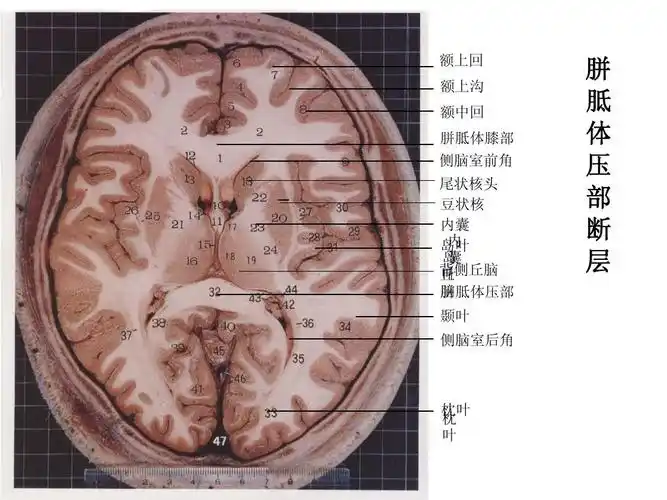 脑部断面解剖ppt