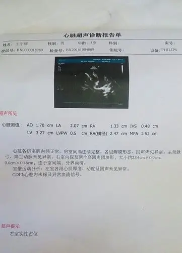 有哪位专家告知一下是什么心脏病