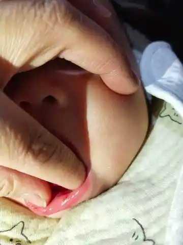 宝宝嘴唇上有小红点点怎么回事 急急急