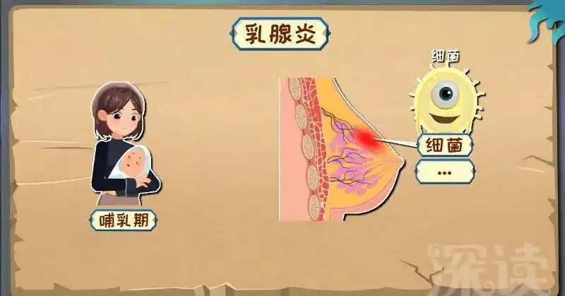 正确了解乳汁分泌,避免急性乳腺炎_乳房_导管_妈妈