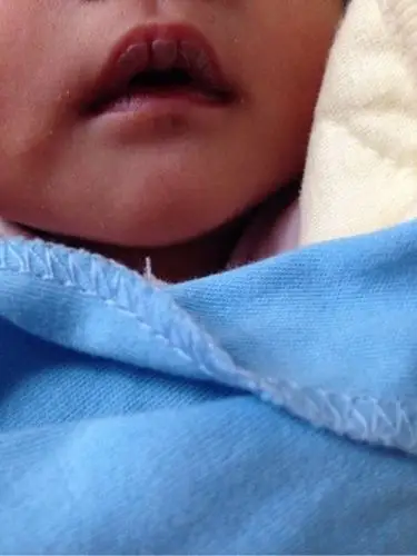 新生儿嘴唇发紫 (6)